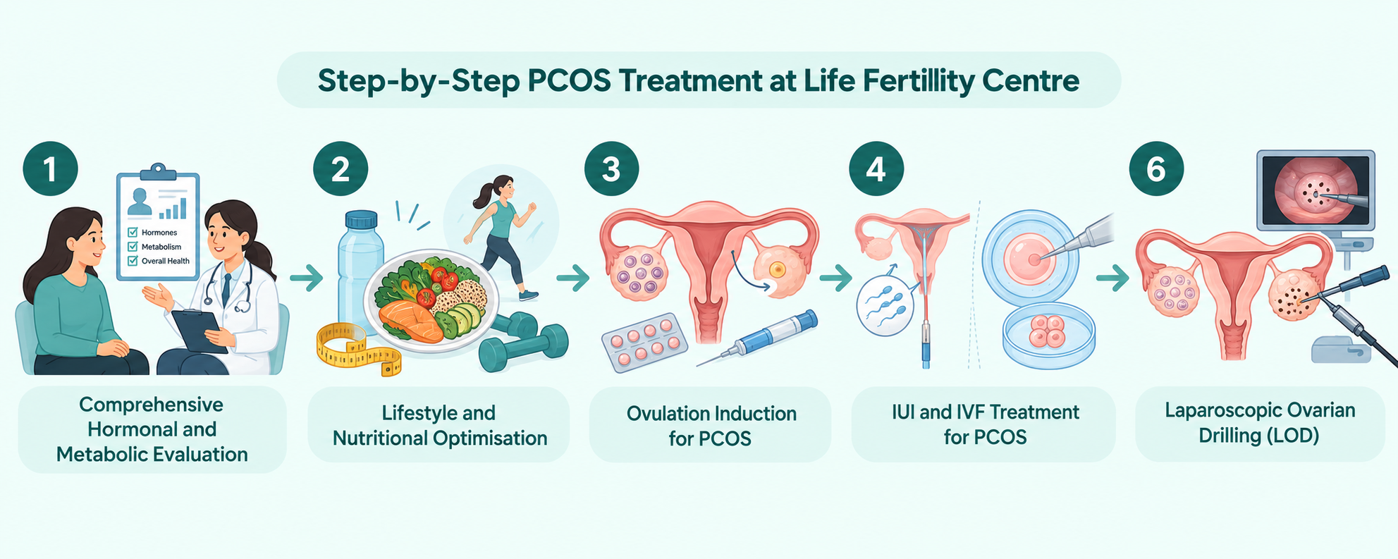 Steps of the PCOS treatment process